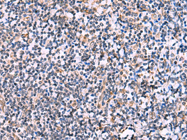 Immunohistochemistry of paraffin-embedded Human tonsil tissue  using NMRK2 Polyclonal Antibody at dilution of 1:55(×200)