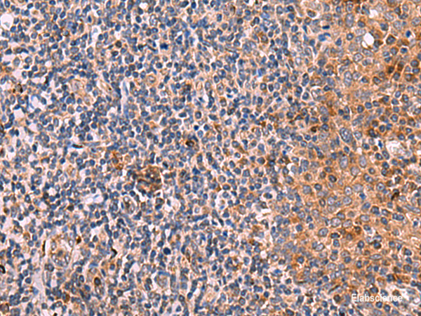 Immunohistochemistry of paraffin-embedded Human tonsil tissue  using KLK9 Polyclonal Antibody at dilution of 1:50(×200)