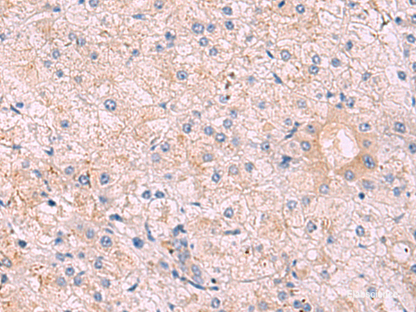 Immunohistochemistry of paraffin-embedded Human tonsil tissue  using KANSL1L Polyclonal Antibody at dilution of 1:40(×200)
