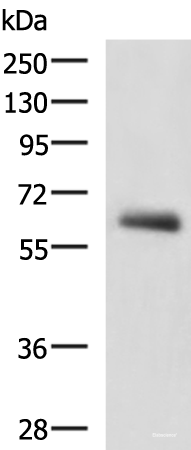 Western blot analysis of Human metastatic papillary carcinoma(thyroid cancer) tissue lysate  using KBTBD11 Polyclonal Antibody at dilution of 1:2300