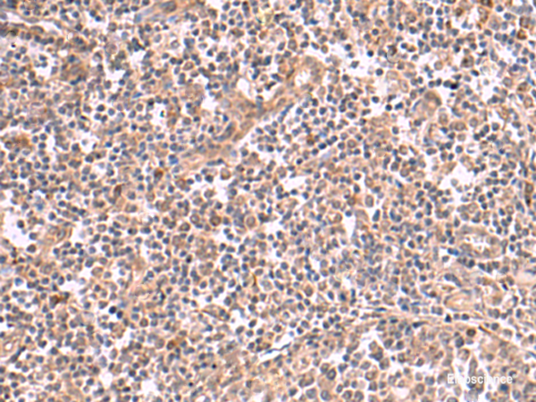 Immunohistochemistry of paraffin-embedded Human tonsil tissue  using SLC12A7 Polyclonal Antibody at dilution of 1:50(×200)