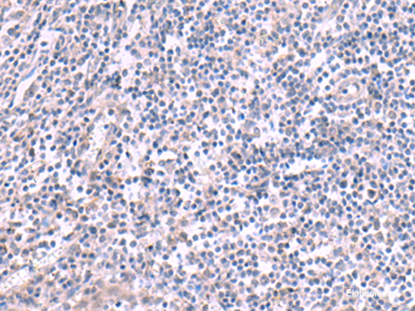 Immunohistochemistry of paraffin-embedded Human tonsil tissue  using KCNK10 Polyclonal Antibody at dilution of 1:45(×200)