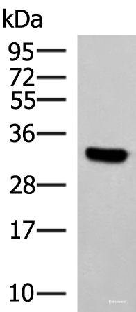 Western blot analysis of Hela cell lysate  using KCTD7 Polyclonal Antibody at dilution of 1:1200