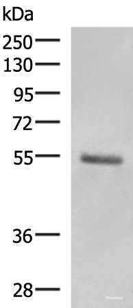 Western blot analysis of Human skin tissue lysate  using KRT36 Polyclonal Antibody at dilution of 1:1000