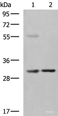 Western blot analysis of Human fetal liver tissue Jurkat cell lysates  using KHK Polyclonal Antibody at dilution of 1:550