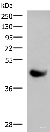 Western blot analysis of Human plasma solution  using KIR2DL5A Polyclonal Antibody at dilution of 1:1000