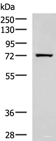 Western blot analysis of Human fetal liver tissue lysate  using SHTN1 Polyclonal Antibody at dilution of 1:600