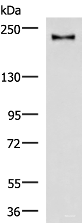 Western blot analysis of Mouse brain tissue lysate  using KIF21B Polyclonal Antibody at dilution of 1:1000