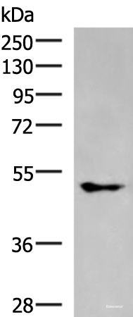 Western blot analysis of A549 cell lysate  using KCNJ2 Polyclonal Antibody at dilution of 1:550