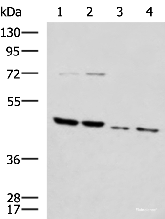 Western blot analysis of Rat brain tissue Mouse brain tissue Raji and 231 cell lysates  using HTRA2 Polyclonal Antibody at dilution of 1:1000