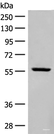 Western blot analysis of Mouse heart tissue lysate  using BAG3 Polyclonal Antibody at dilution of 1:250