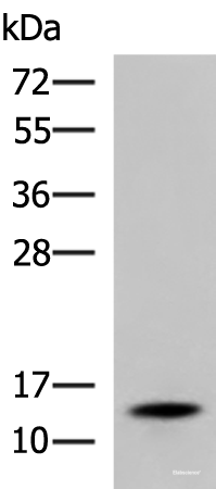 Western blot analysis of Mouse serum  using TTR Polyclonal Antibody at dilution of 1:600