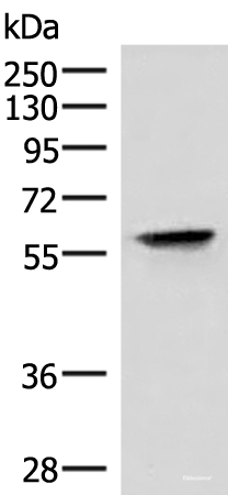 Western blot analysis of Hela cell lysate  using VIM Polyclonal Antibody at dilution of 1:4000