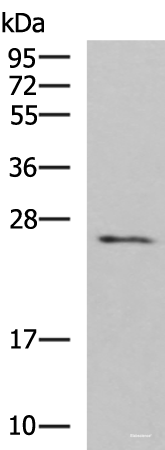 Western blot analysis of Human fetal brain tissue lysate  using CLEC4D Polyclonal Antibody at dilution of 1:700