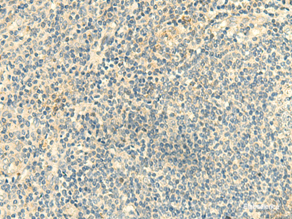 Immunohistochemistry of paraffin-embedded Human tonsil tissue  using CLEC10A Polyclonal Antibody at dilution of 1:50(×200)