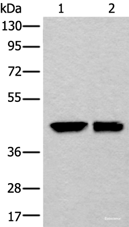 Western blot analysis of HEPG2 and 231 cell lysates  using DLK1 Polyclonal Antibody at dilution of 1:250