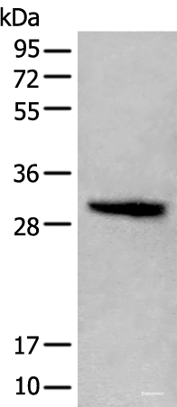 Western blot analysis of Jurkat cell lysate  using HIST1H1C Polyclonal Antibody at dilution of 1:400
