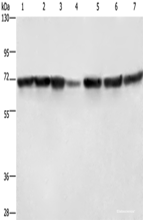 Western blot analysis of Hela cells HT29 cells human fetal liver tissue Human testis tissue 231 cells K562 cells human bladder transitional cell carcinoma tissue  using LMNB1 Polyclonal Antibody at dilution of 1:750