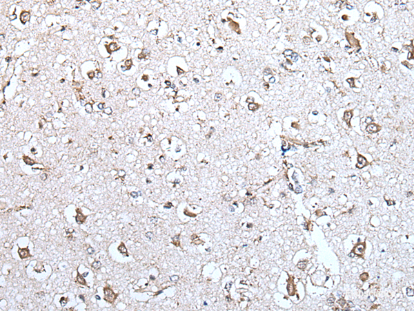 Immunohistochemistry of paraffin-embedded Human brain tissue  using MCM10 Polyclonal Antibody at dilution of 1:45(×200)