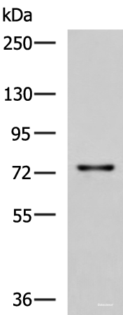 Western blot analysis of Rat liver tissue lysate  using TGFBI Polyclonal Antibody at dilution of 1:850