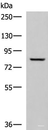 Western blot analysis of Human tongue tissue lysate  using TGM3 Polyclonal Antibody at dilution of 1:800