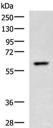 Western blot analysis of A549 cell lysate  using TERF1 Polyclonal Antibody at dilution of 1:400