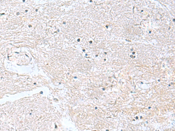 Immunohistochemistry of paraffin-embedded Human brain tissue  using CACNB1 Polyclonal Antibody at dilution of 1:100(×200)