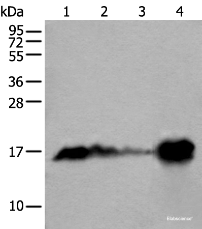 Western blot analysis of Human heart tissue Mouse heart tissue Rat heart tissue and Human muscle tissue lysates  using MB Polyclonal Antibody at dilution of 1:400