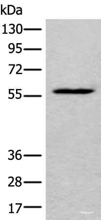 Western blot analysis of HEPG2 cell lysate  using LDHD Polyclonal Antibody at dilution of 1:400
