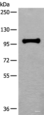 Western blot analysis of HEPG2 cell lysate  using HELLS Polyclonal Antibody at dilution of 1:400