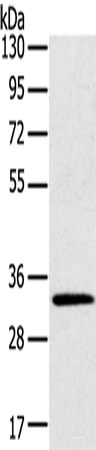 Western blot analysis of Mouse brain tissue  using STK16 Polyclonal Antibody at dilution of 1:400