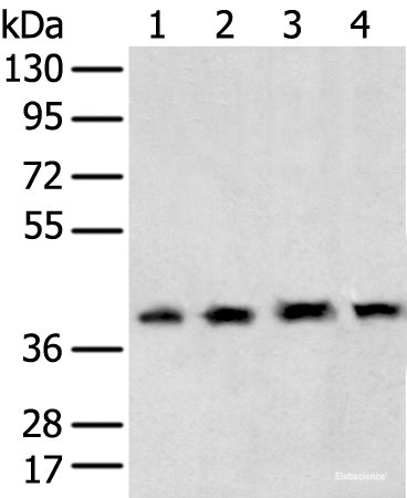 Western blot analysis of 231 cell Human testis tissue Hela and Hepg2 cell  using TBP Polyclonal Antibody at dilution of 1:400