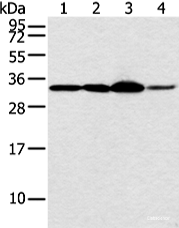 Western blot analysis of Hela and PC3 cell 231 cell and human esophagus cancer tissue  using MED6 Polyclonal Antibody at dilution of 1:400
