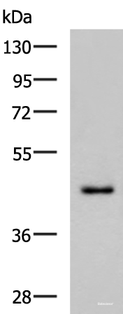 Western blot analysis of TM4 cell lysate  using WDR4 Polyclonal Antibody at dilution of 1:700