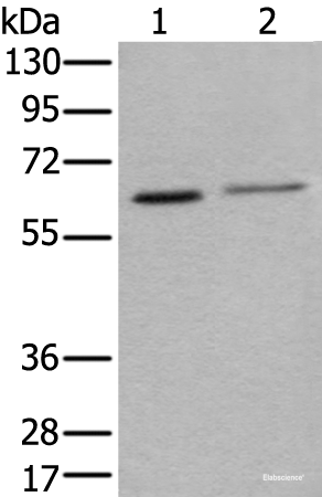 Western blot analysis of Hela and A549 cell lysates  using YY1 Polyclonal Antibody at dilution of 1:400