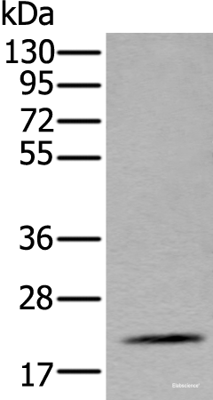 Western blot analysis of Mouse fat tissue lysate  using ZFAND5 Polyclonal Antibody at dilution of 1:500