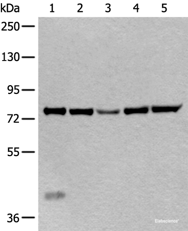 Western blot analysis of Mouse liver tissue Hela cell Human testis tissue Jurkat and HEPG2 cell lysates  using ATF6B Polyclonal Antibody at dilution of 1:300