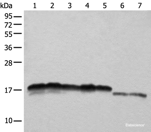 Western blot analysis of Hela HEPG2 A431 K562 and 231 cell Mouse liver tissue and Mouse brain tissue lysates  using NDUFB11 Polyclonal Antibody at dilution of 1:1000