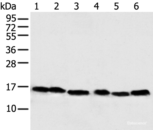 Western blot analysis of 293T Hela PC-3 Lncap and 231 cell Human fetal muscle tissue  using NDUFB6 Polyclonal Antibody at dilution of 1:500