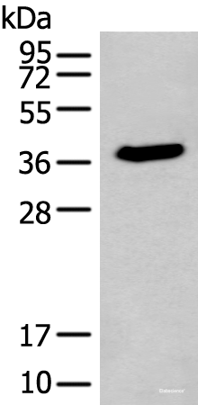 Western blot analysis of HEPG2 cell lysate  using ACBD4 Polyclonal Antibody at dilution of 1:400
