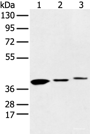 Western blot analysis of 231 cell Human fetal liver and Human fetal brain tissue  using MAT2B Polyclonal Antibody at dilution of 1:500