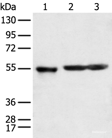 Western blot analysis of Human cerebrum tissue rat brain tissue and Mouse brain tissue  using KCTD16 Polyclonal Antibody at dilution of 1:350