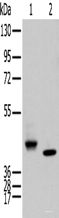 Western blot analysis of Human fetal brain tissue and Human kidney tissue  using IDO2 Polyclonal Antibody at dilution of 1:450
