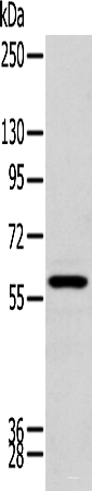 Western blot analysis of Human kidney tissue  using ZNF248 Polyclonal Antibody at dilution of 1:200