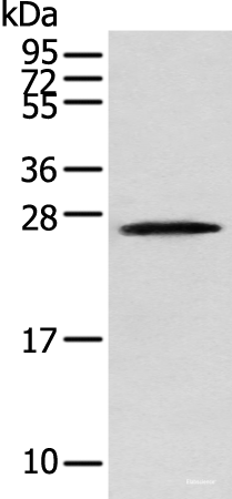 Western blot analysis of Human fetal brain tissue  using TPPP Polyclonal Antibody at dilution of 1:250