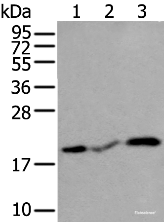 Western blot analysis of Human heart tissue Rat heart tissue and Mouse heart tissue lysates  using CSRP3 Polyclonal Antibody at dilution of 1:400