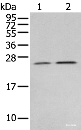 Western blot analysis of Human fetal brain tissue 231 cell  using RAB11A Polyclonal Antibody at dilution of 1:400
