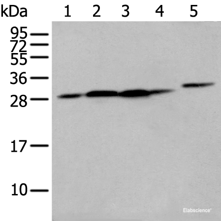 Western blot analysis of 293T cell Human fetal liver tissue A549 and Hepg2 cell  using FKBP7 Polyclonal Antibody at dilution of 1:400