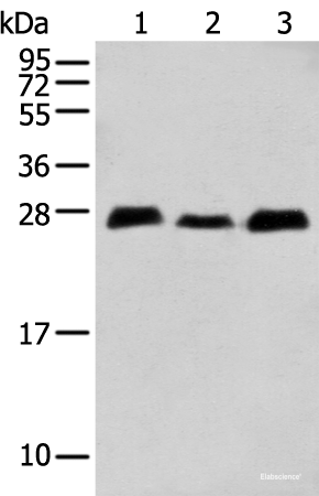 Western blot analysis of Human fetal brain tissue Human cerebrum tissue Mouse brain tissue  using MOB4 Polyclonal Antibody at dilution of 1:400