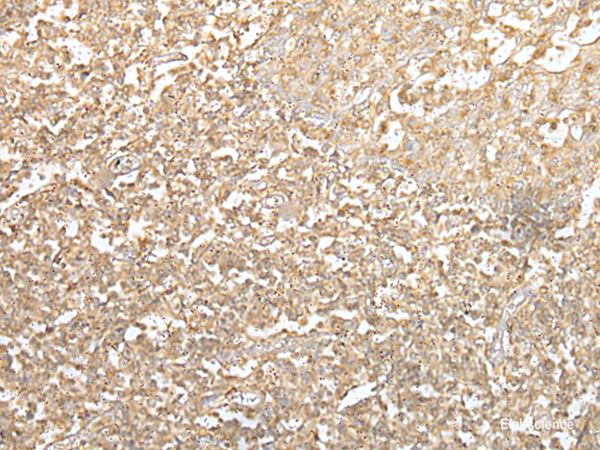 Immunohistochemistry of paraffin-embedded Human tonsil tissue  using SPIC Polyclonal Antibody at dilution of 1:55(×200)